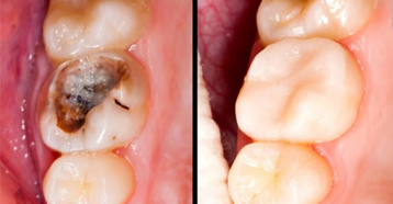Dentistica