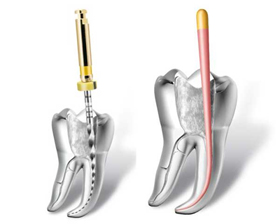 Endodontia