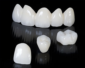 Facetas de Porcelana