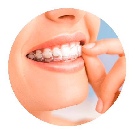 Ortodontia com alinhadores invisíveis